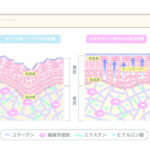 健康な肌、不健康な肌図のサムネイル